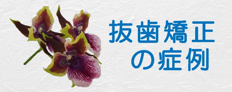 抜歯矯正の症例