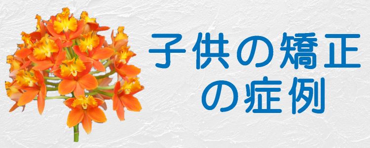 子供の矯正の症例