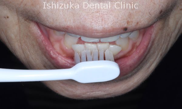 ブラシの先を使って細かいところを磨く