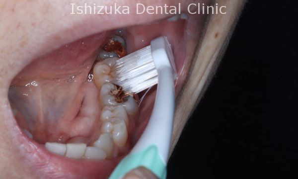 ブラシの面を使って広いところを磨く