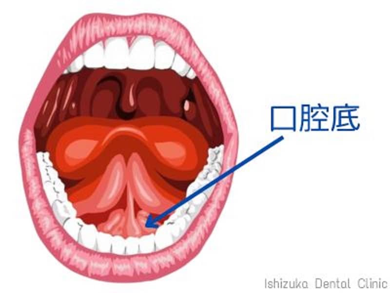 口底癌的症状和图片 | 口腔癌 初期症状 しこり 写真 | 口腔癌的早期症状与预防措施-京东健康 – ASQK